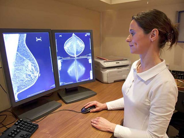 Dutch Collaboration for Radiologist-AI Integration in Mammography